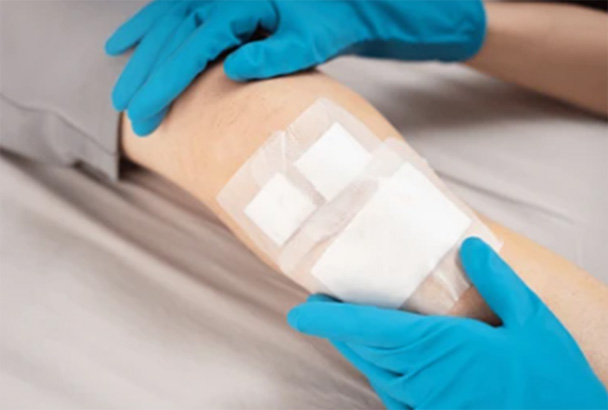 Pansement hémostatique pour aider la cicatrisation d'une plaie