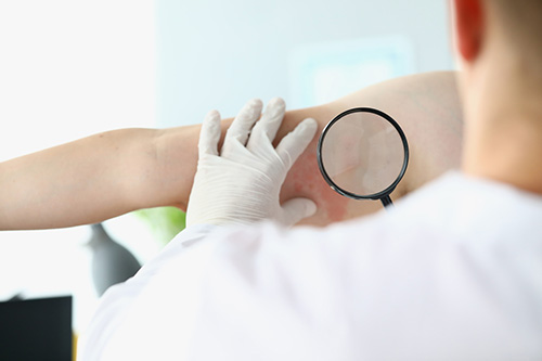 consulter un médecin en cas d'intertrigo persistant