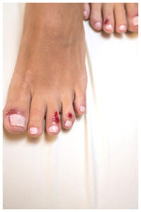 soigner rapidement une coupure au pied